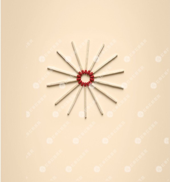 三期内痔治好病例